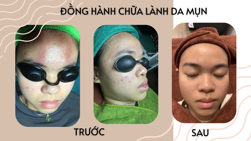 Các lĩnh vực khác trong danh mục Tư vấn - Tư vấn làm đẹp  - 5