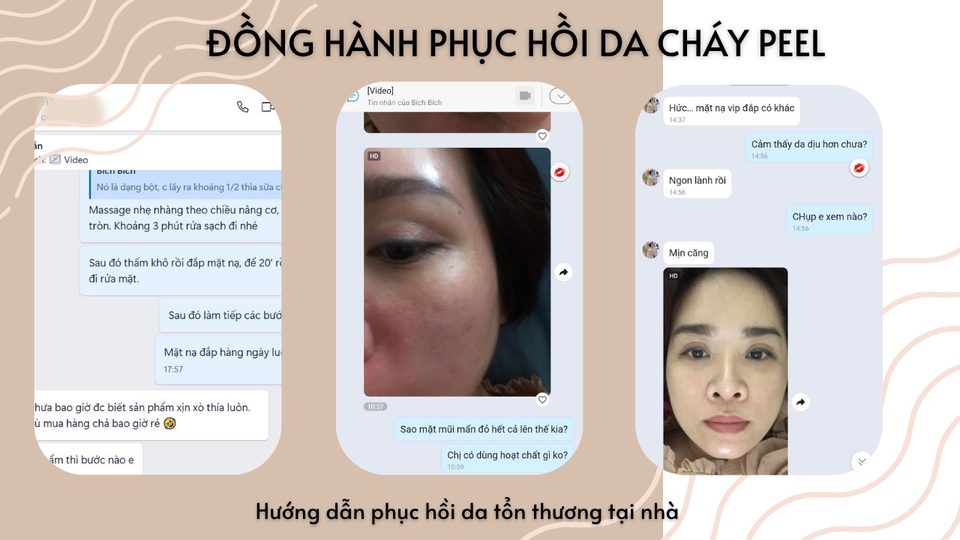 Các lĩnh vực khác trong danh mục Tư vấn - Tư vấn làm đẹp  - 3